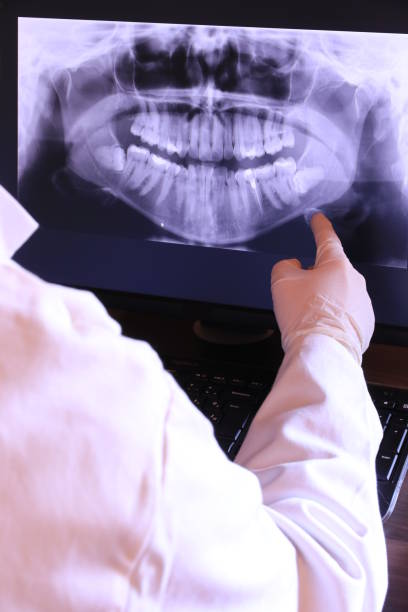 Best Emergency Wisdom Teeth Removal in Fulton, MS