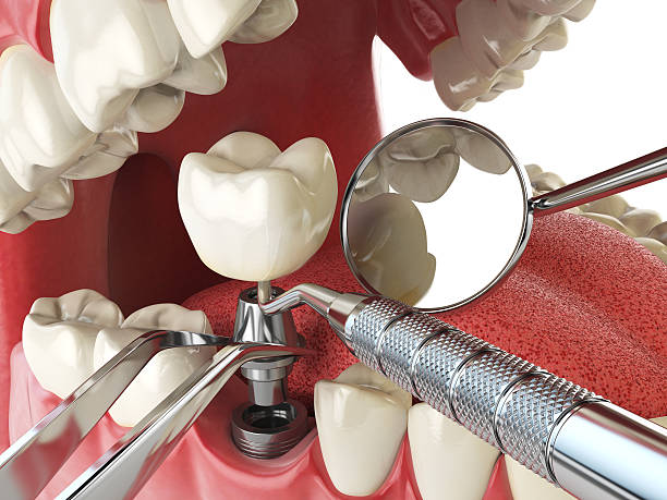 Best Cosmetic Emergency Dentistry in Fulton, MS