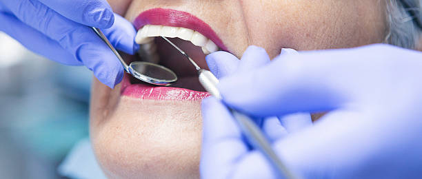 Best Emergency Tooth Extraction in Fulton, MS